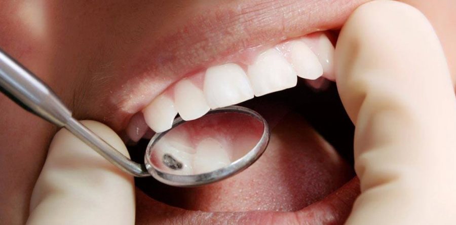 Odontoiatria conservativa